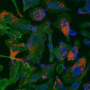 ננו-שלדים (באדום) ששוגרו לרקמת אדם הנגועה בסרטן הערמונית. התאים הנגועים צבועים בתרשים כחול (גרעין) ובירוק (ציטופלזמה), ואפשר לראות כיצד הננו-שלדים מגיעים אליהם