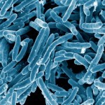 Mycobacterium tuberculosis Bacteria 