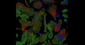 תמונת מיקרוסקופ פלורסנטי; תאים סרטניים (צבועים בירוק) שבתוכם אפשר לראות את רוחות הרפאים הננומטריות (צבועות באדום).