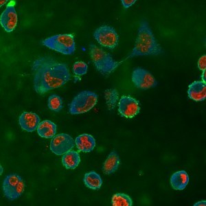 תמונת חתך ממיקרוסקופ קונפוקלי: תאי סרטן שד בעלי פוטנציאל מטסטטי גבוה דוחפים לתוך ג'ל פוליאקרילאמיד בקשיחות של 2.4 kPa, כאשר חתך זה הוא בעומק של 10.6 מיקרון מתחת גובה פני הג'ל. בתמונה אפשר לראות את גרעיני התאים (אדום), את אלמנט האקטין בשלד התוך תאי (ירוק) ואת חיבורי התאים למשטח במוקדי חיבור (כחול).