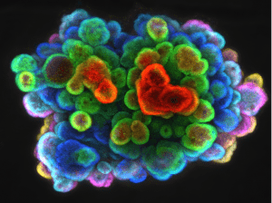 מיני איבר (אורגנואיד) של המעי הדק שנמחק בו הגן ארטס. כתוצאה מכך נישת תאי הגזע מתרחבת. התמונה צולמה על ידי הקרנה של כל מישור פוקלי.