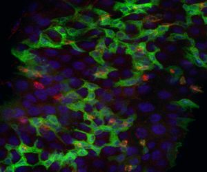 צילום מיקרוסקופ קונפוקלי: חתך במעי הזבוב הבוגר: תאי גזע העוברים התמיינות משובשת