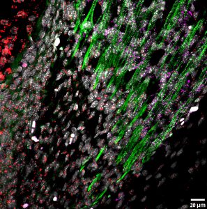 the RNA of LOXL3 in red, that of MYOD in purple and immunostaining of the muscle fibers in green.