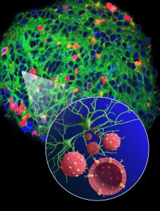 "Neurosomes"- Humanized Biomimetic nano vesicles (red) for neuron targeting (green) 