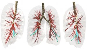 Three views of the lung environment