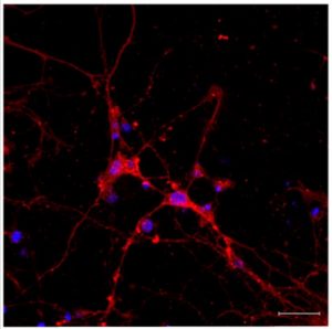 הצטברותם של הננו-חלקיקים בתרבית תאים של נוירונים (באדום - הננו-חלקיקים, בכחול - גרעיני התאים).