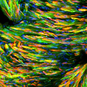 The implanted construct: the engineered muscle fibers (in red) express the GLUT4 (in green)