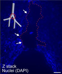 Fluorescent bright-field microscopy imaging reveals a region of cell detachment localized at the first bifurcation. The epithelial cells are stained blue.