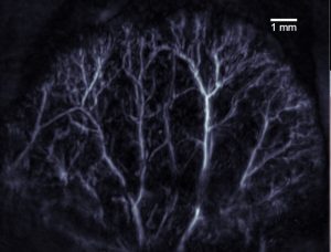 תמונה של מיפוי כלי דם באמצעות שיטת הדימות האופטואקוסטית שפיתחו חוקרי הטכניון