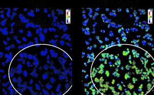 Calcium cell level. On the left – intervention-free; on the right – after using the technology developed by the Technion research group. The white circle marks the illuminated area in which the light activates the molecule that triggers calcium influx into the cell.