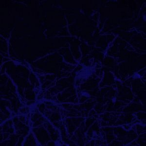 בתמונה המדעית: נוירונים של שליו שהודבקו בנגיף שפיתחו חוקרי הטכניון. על גבי הנוירונים אפשר לראות מבנים הקרויים spines 