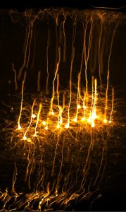 הצילום הזוכה: יער הנוירונים הזוהר