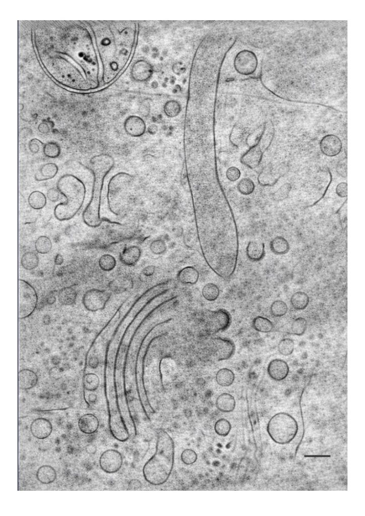 חתך מתוך שחזור תלת־ממדי, הממחיש את הארגון הצפוף של הסביבה התוך־תאית. התא הוקפא כדי לשמר את המבנים הפנימיים בשלמותם, ובהם מיטוכונדריה. קנה המידה: 100 ננומטר, כאלפית מעובייה של שערה. (קרדיט: ד״ר נטליה לוגבינה, עמיתת מחקר במעבדה של ד״ר ליה אנגל)