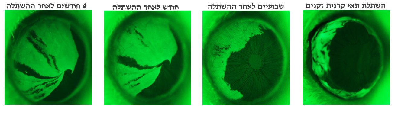 החוקרים גילו כי תאים "זקנים" הופכים לתאים דמויי תאי גזע צעירים המחדשים את הקרנית לאורך חודשים ומונעים התפתחות מחלה.